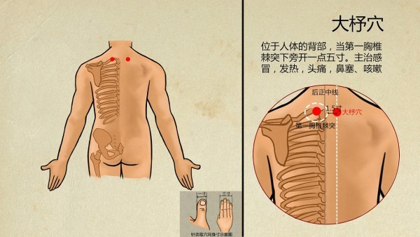 腹泻的护理要点介绍