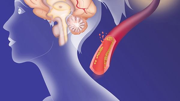 得了甲状腺癌会传染吗