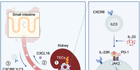 肠道免疫参与肾脏纤维化过程的新发现