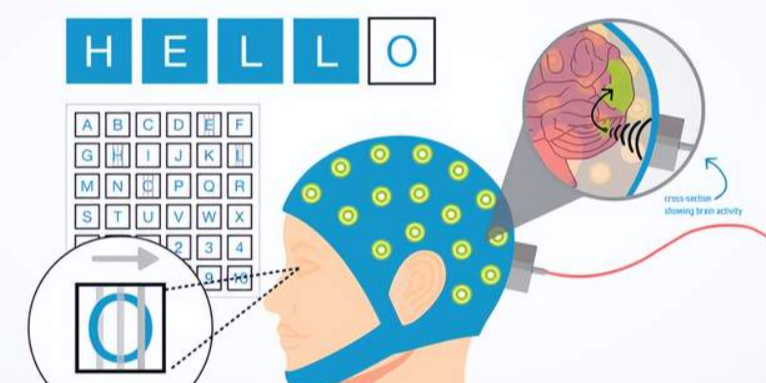 卡内基梅隆大学研究团队首次实现双向脑机接口技术
