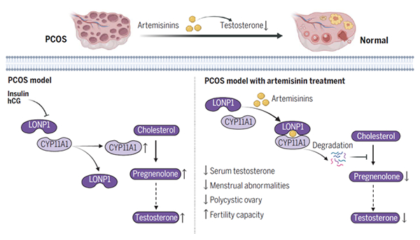 我国在青蒿素治疗多囊卵巢综合征研究方面取得进展