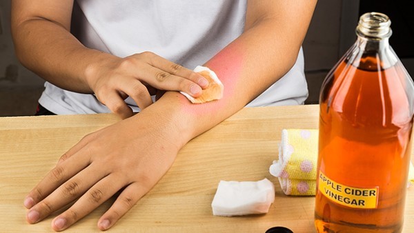 皮肤脓肿的症状表现及治疗方法