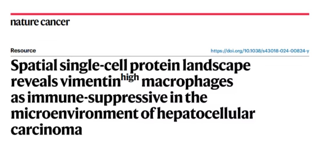 HCC肿瘤微环境的空间异质性及VIM高表达巨噬细胞在肿瘤进展中的作用