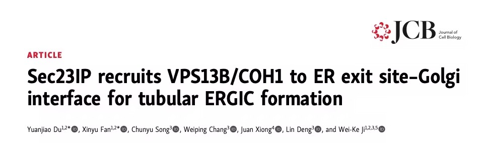 VPS13B在内质网-高尔基体转运中的关键作用及其与Cohen综合征的关联