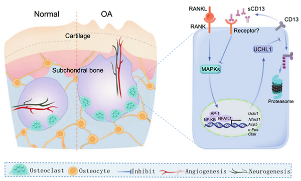 RANKL-UCHL1-sCD13负反馈环路在骨关节炎中的作用机制研究